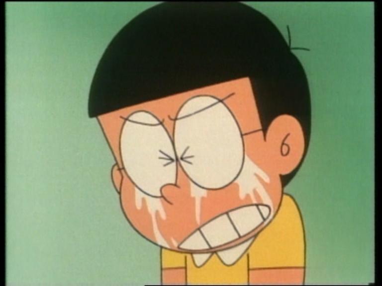 Nobita from Doraemon. 