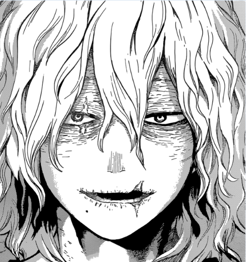 Is There Anyone Who Resembles Tomura Shigaraki In Real Life My Hero