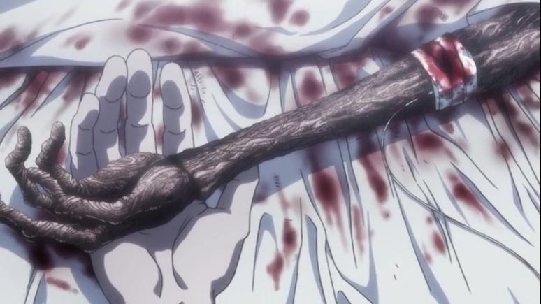 Hunter X Hunter 2011 Episode 145 Discussion Forums Myanimelist Net