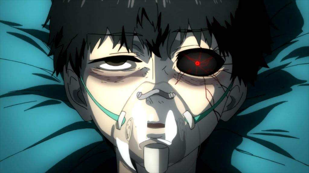 Featured image of post Lifeless Eyes Anime